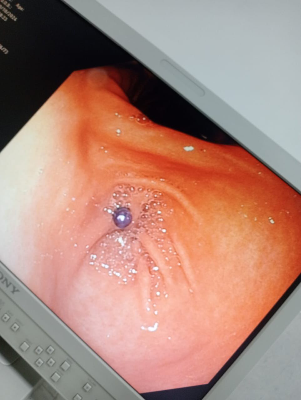 Slide 3